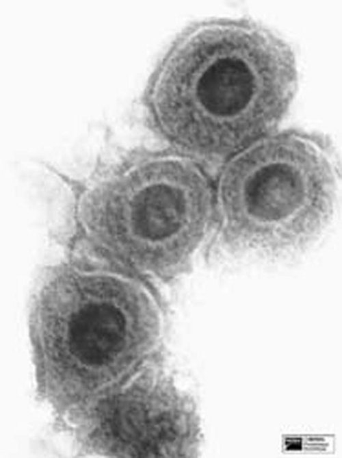 Herpesvirus (1000fache Vergrößerung) Foto:©Merial GmbH Herpesvirus (1000fache Vergrößerung) Foto:©Merial GmbH
