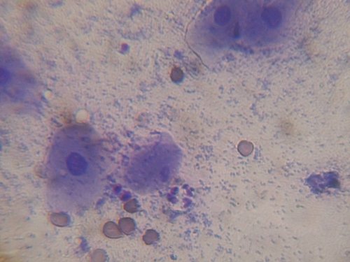 Vaginalzytologie bei einer Hündin im Proöstrus: Es dominieren Erythrozyten und Intermediärzellen. (Quelle: Wikipedia) - Foto:©Uwe Gille/Wikimedia Commons Vaginalzytologie bei einer Hündin im Proöstrus: Es dominieren Erythrozyten und Intermediärzellen. (Quelle: Wikipedia) - Foto:©Uwe Gille/Wikimedia Commons