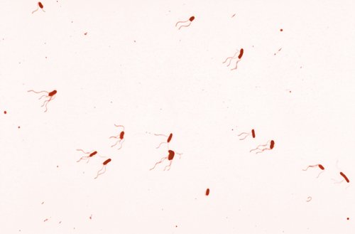 Lichtmikroskopisches Bild von Bordetella bronchisptica in einer Geißelfärbung nach Leifson (nachträglich digital eingefärbt). Foto:©CDC/Dr.William A.Clark/Marco Tolo/wikimedia commons Lichtmikroskopisches Bild von Bordetella bronchisptica in einer Geißelfärbung nach Leifson (nachträglich digital eingefärbt). Foto:©CDC/Dr.William A.Clark/Marco Tolo/wikimedia commons